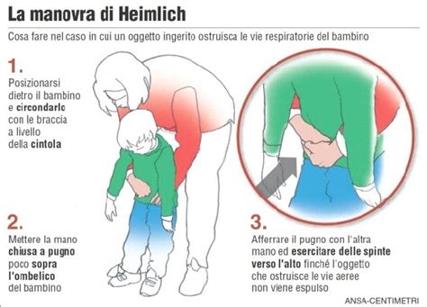 Questa sera MANOVRE DI DISOSTRUZIONE PEDIATRICA col 